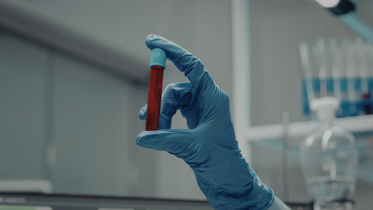 Test mononucleosi