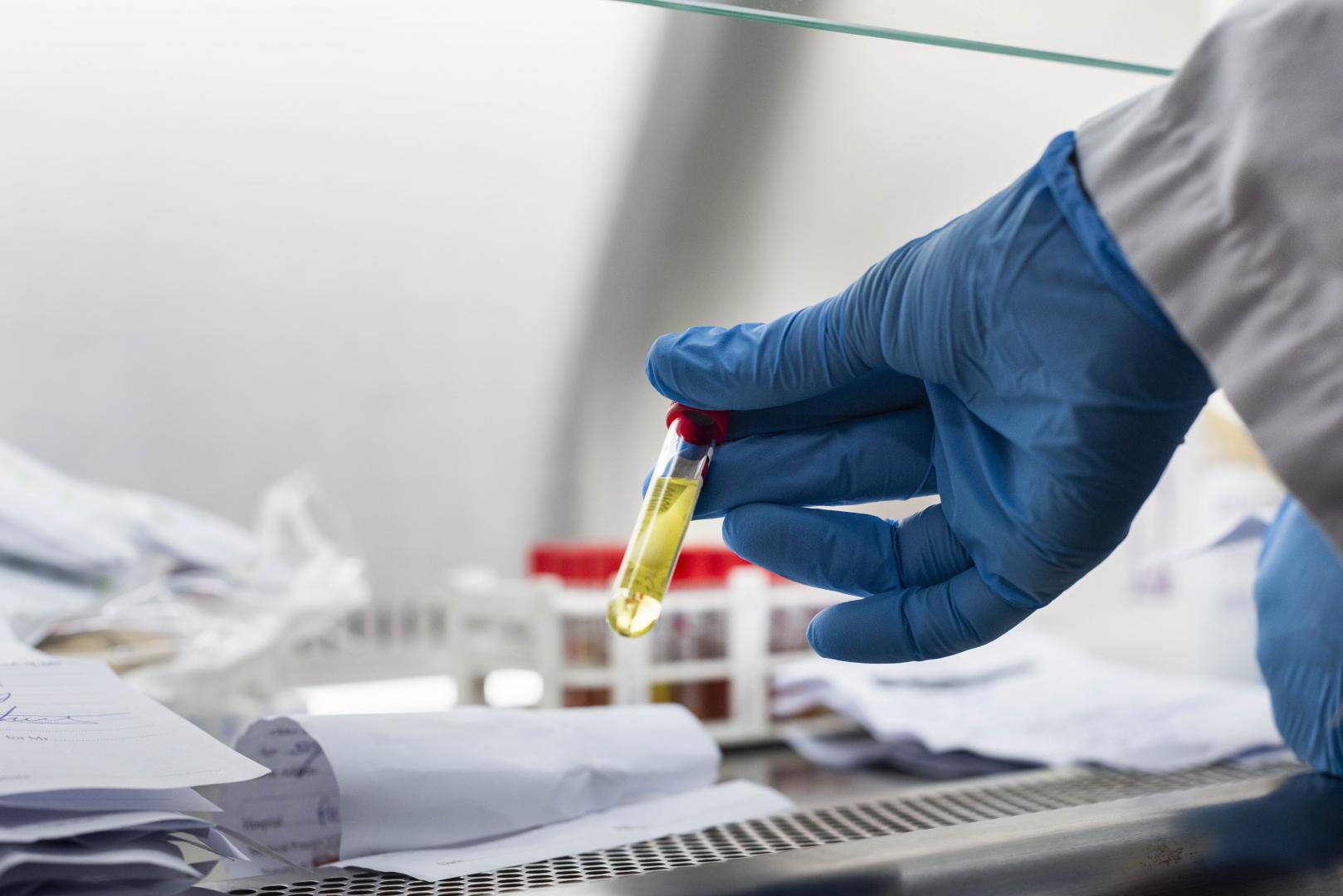 Les pays africains et la vaccination