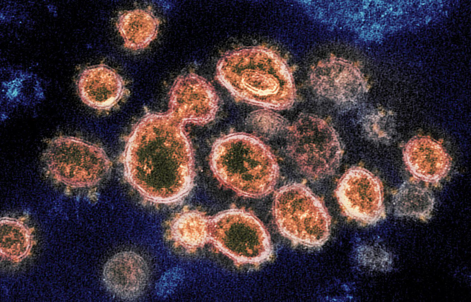 Les scientifiques détectent un nouveau coronavirus