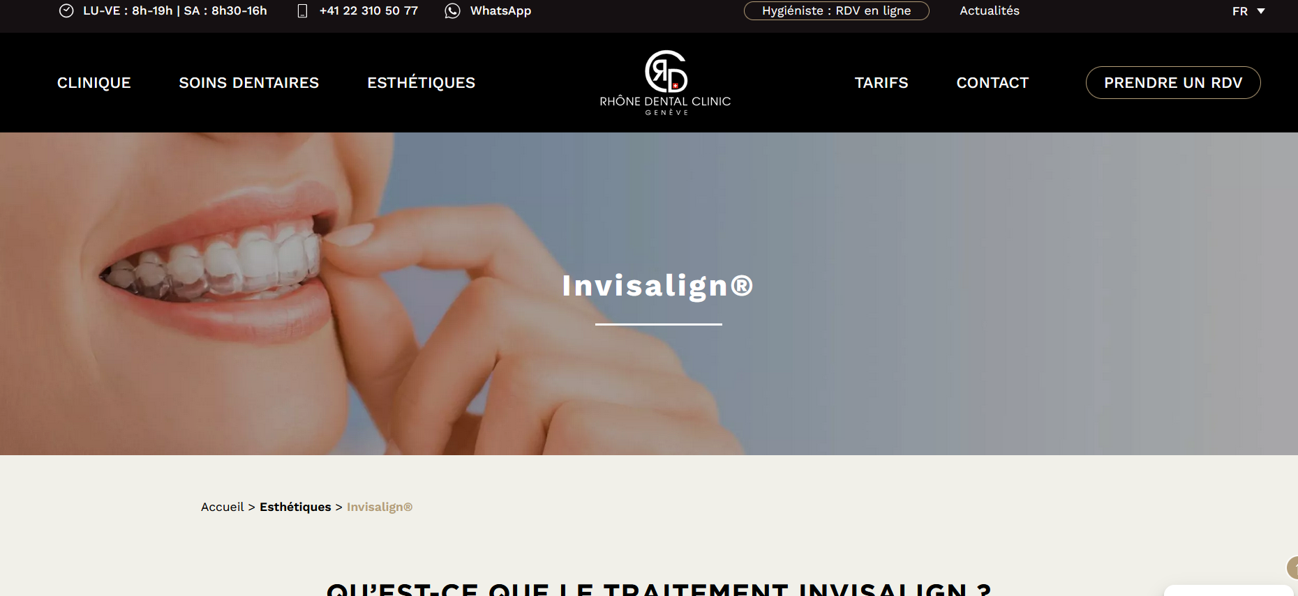 Solutions contre les dents jaunes ?