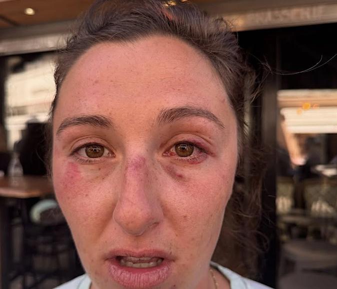 Agression sur un ferry : une passagère blessée, un rassemblement de soutien prévu à Porto-Vecchio Agression sur un ferry : une passagère blessée, un rassemblement de soutien prévu à Porto-Vecchio