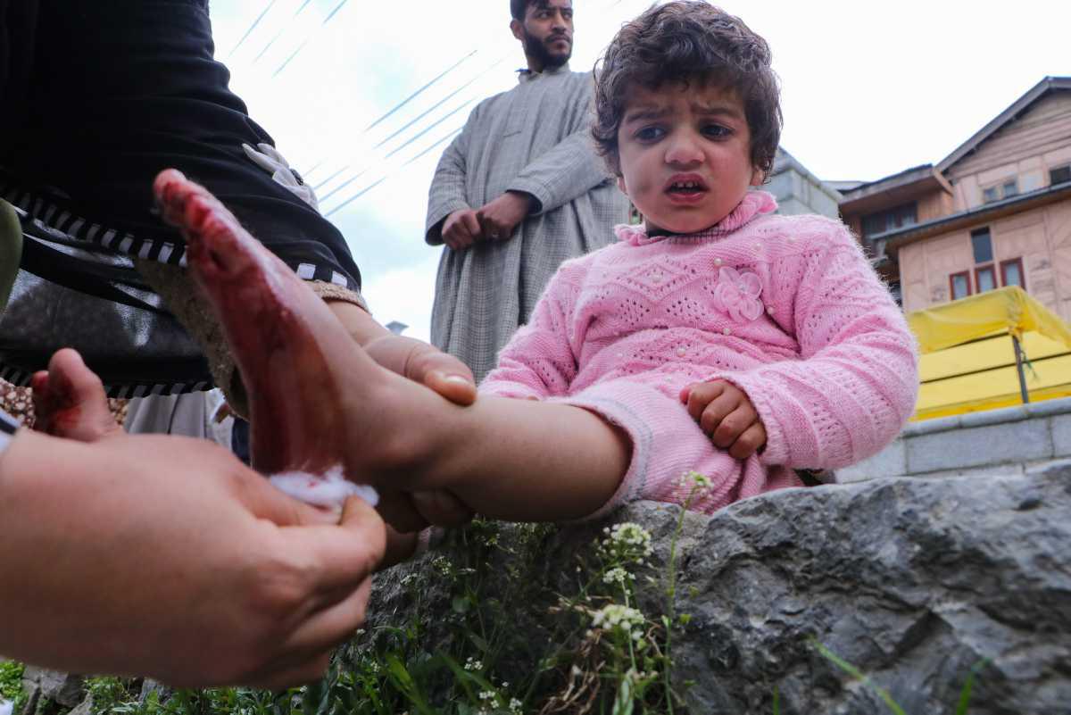 [Focus] - Au Kashmir, on se soigne les maux de l'hiver avec des sangsues