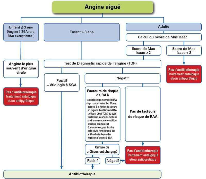 Angine aiguë (enfant)