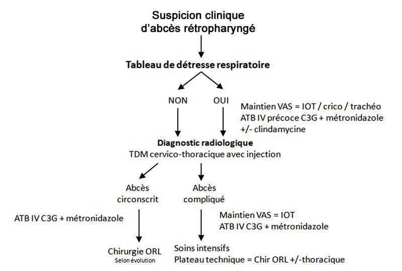 Abcès rétropharyngé