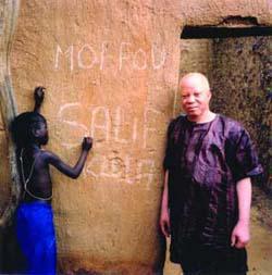 La Fondation Salif Keita pour les albinos du Mali