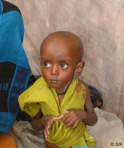 Dans le sud de la Somalie, 640 000 enfants souffrent de malnutrition dont 310 000 atteints de malnutirtion aigüe.