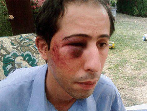 Nouredine Rachedi après son agression en août 2008.