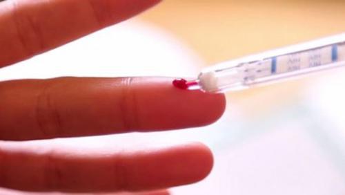 Sida : un autotest de dépistage bientôt dans les pharmacies