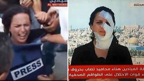 Blessée par une grenade israélienne, la journaliste fait le job (vidéo)