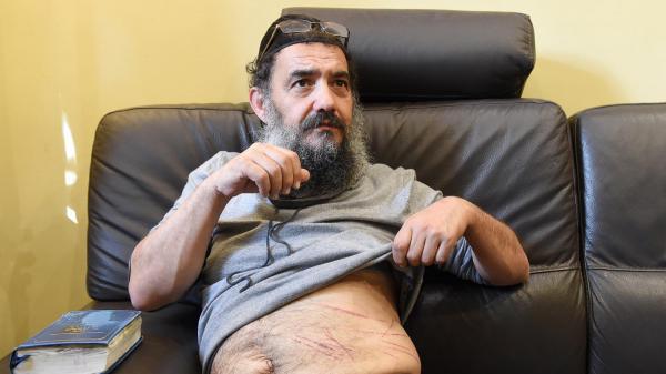 Tzion Saadoun exhibant des blessures qui lui auraient été infligées par des admirateurs de Merah et de Daesh.