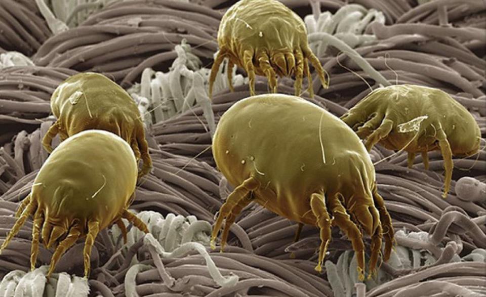 Allergie