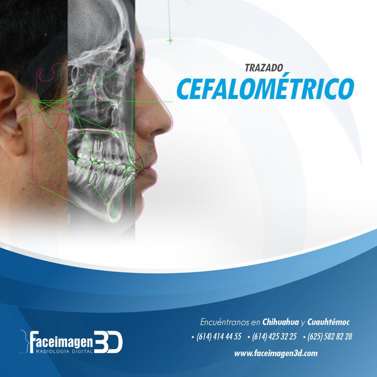 Faceimagen3D
