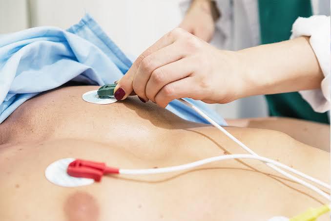 Elettrocardiogramma (ECG)