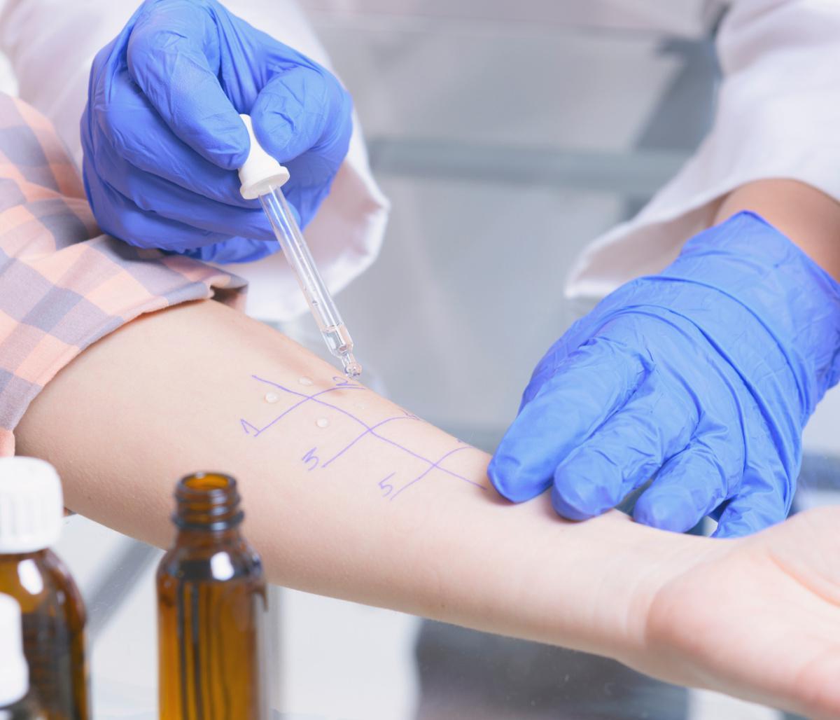 Test allergie inalanti/alimenti