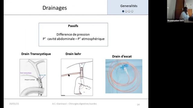 Chirurgie digestive lourde - Techniques, drainages et complications - Dr Gianinazzi