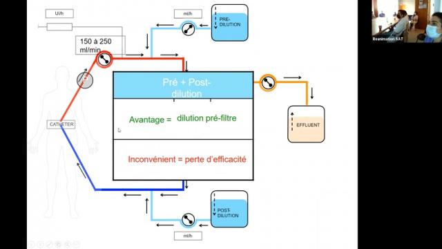Epuration extra-rénale en réanimation - Dr Satre-Buisson