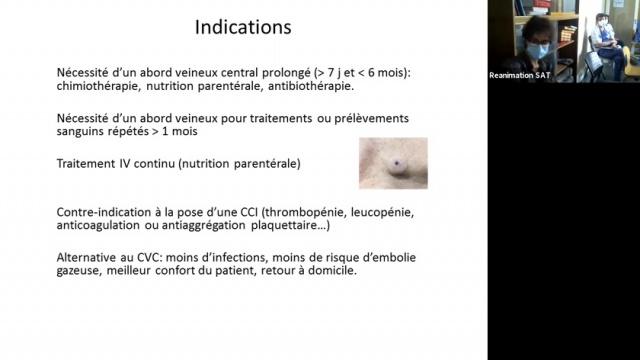 Nouveaux accès vasculaires - Dr S. Roche