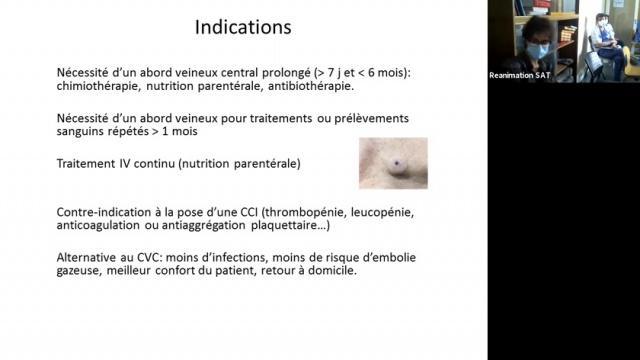 Nouveaux accès vasculaires - Dr S. Roche