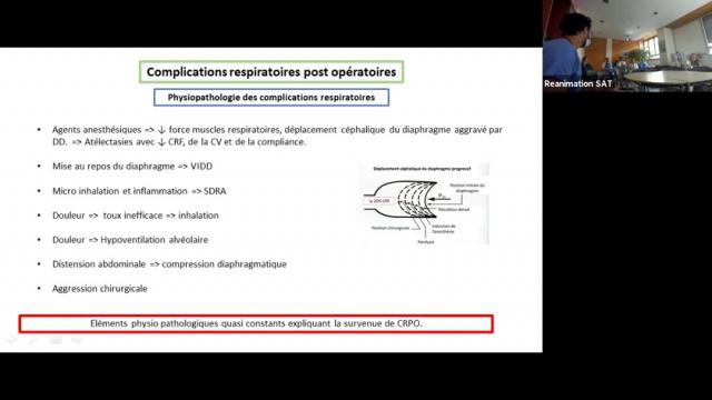 VNI prophylactique en chirurgie digestive - M. Abbas