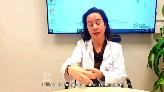 ¿Qué es el linfedema? ¿Si me extirpan los ganglios linfáticos me va a provocar un linfedema?