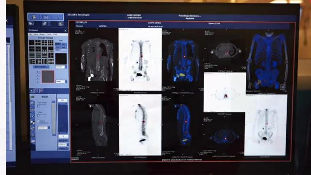 Vidéo Présentation