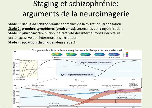 Staging: Classification par stade dans la schizophrénie