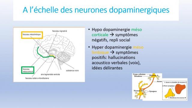 Les causes de la schizophrénie