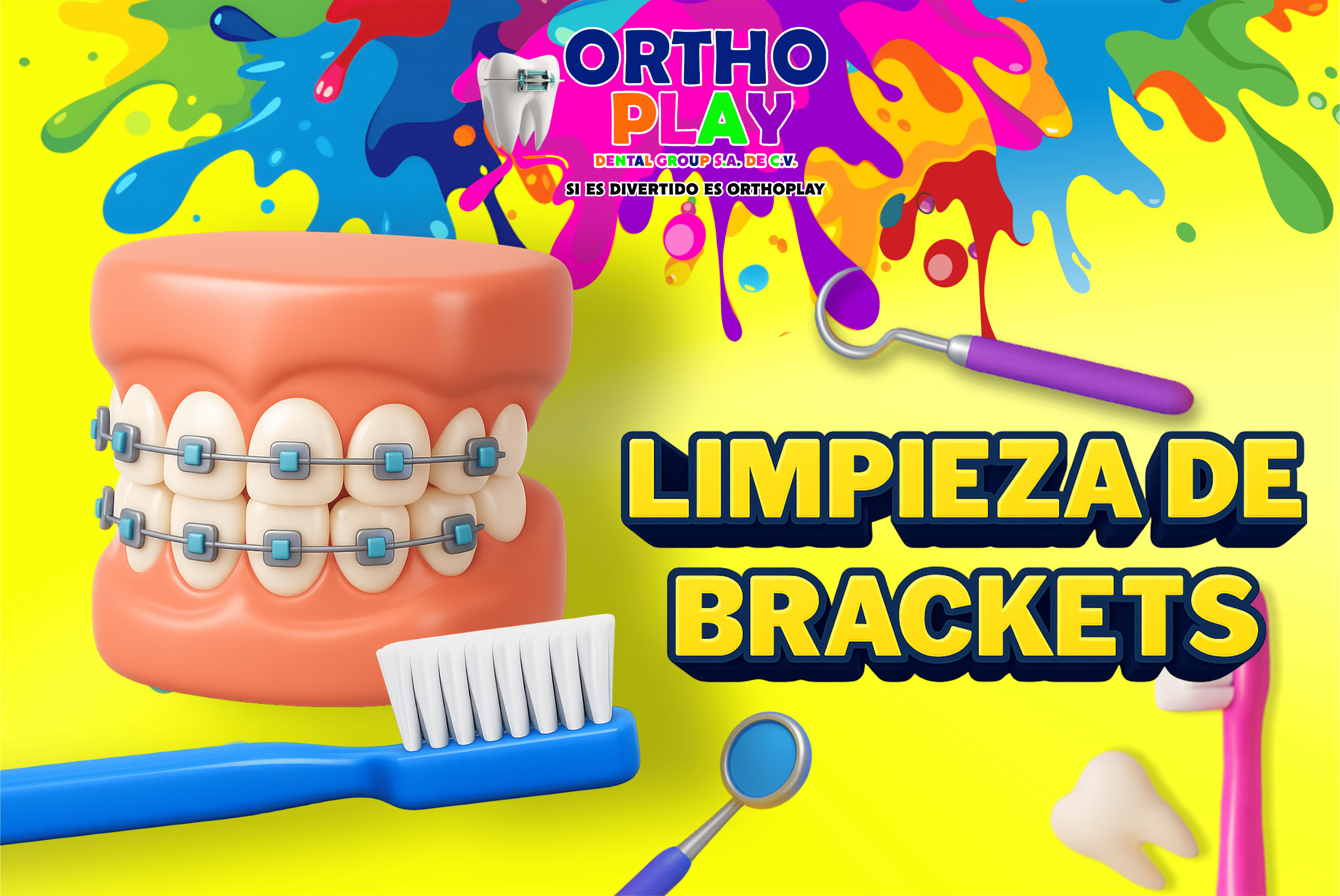 COMO LIMPIAR CORRECTAMENTE LOS BRACKETS Y EVITAR CARIES