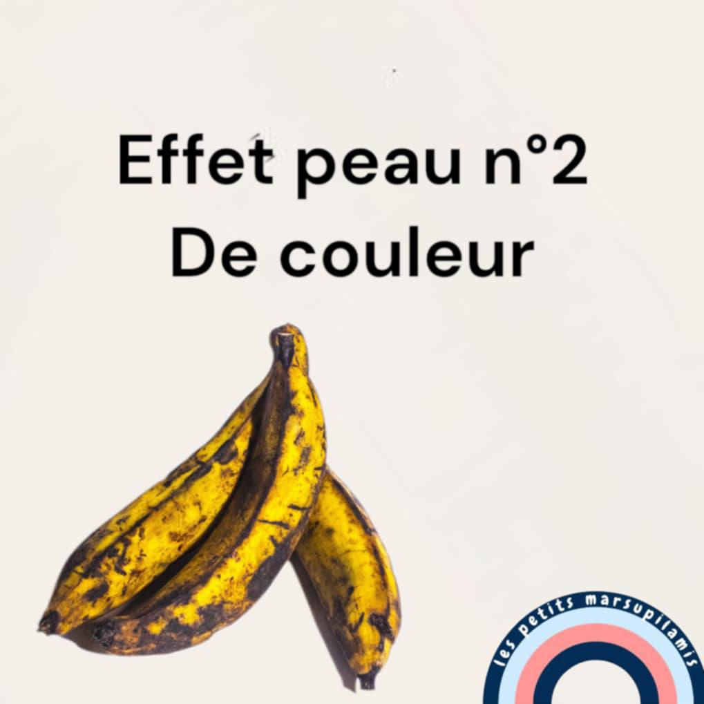 Présentation prothèse effet peau n°2 de couleur 