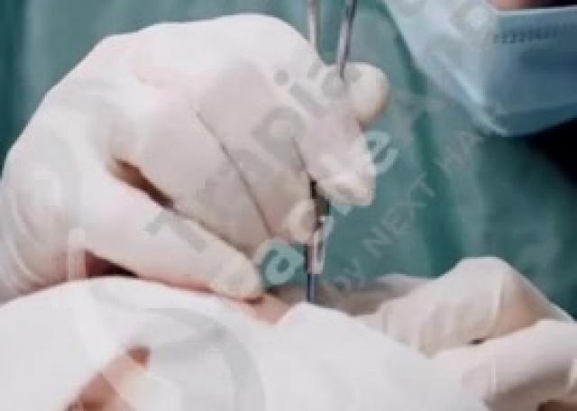 04 - Apertura canali operazione FUE