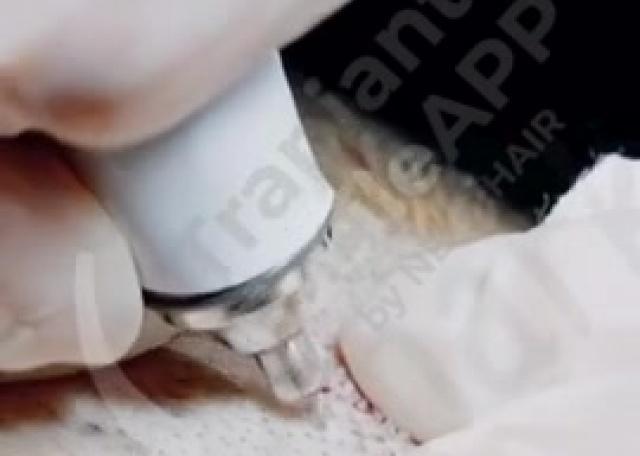 Testimonianze video - Fase operazione