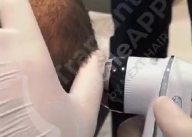 Testimonianze video - Visita di controllo e disegno Hairline