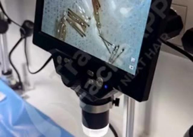 Testimonianze video - suddivisioni grafts