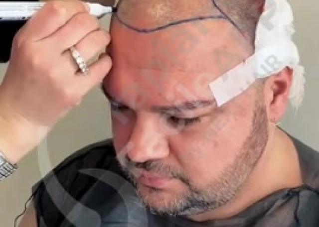 Disegno Hairline