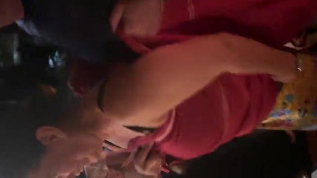 the Siamese twins….